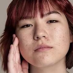 Savvy Girl Repair Acne Skin